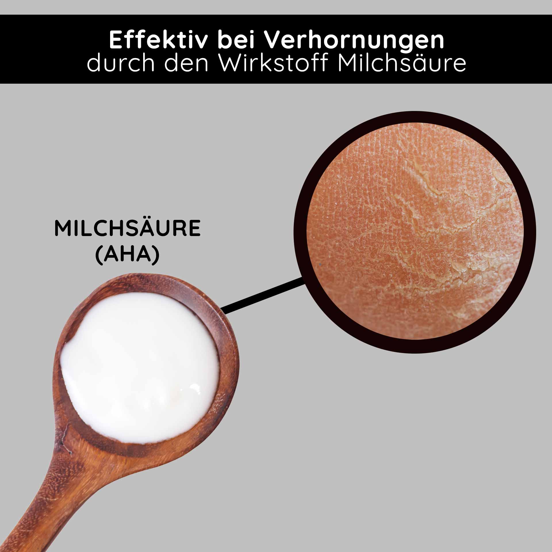 Fruit Acid & BHA Cream 50 ml - Crème aux acides de fruits BHA Milchsäure (AHA) in einem Holzlöffel, wirksam gegen Verhornungen, mit Hauttextur im Detail.