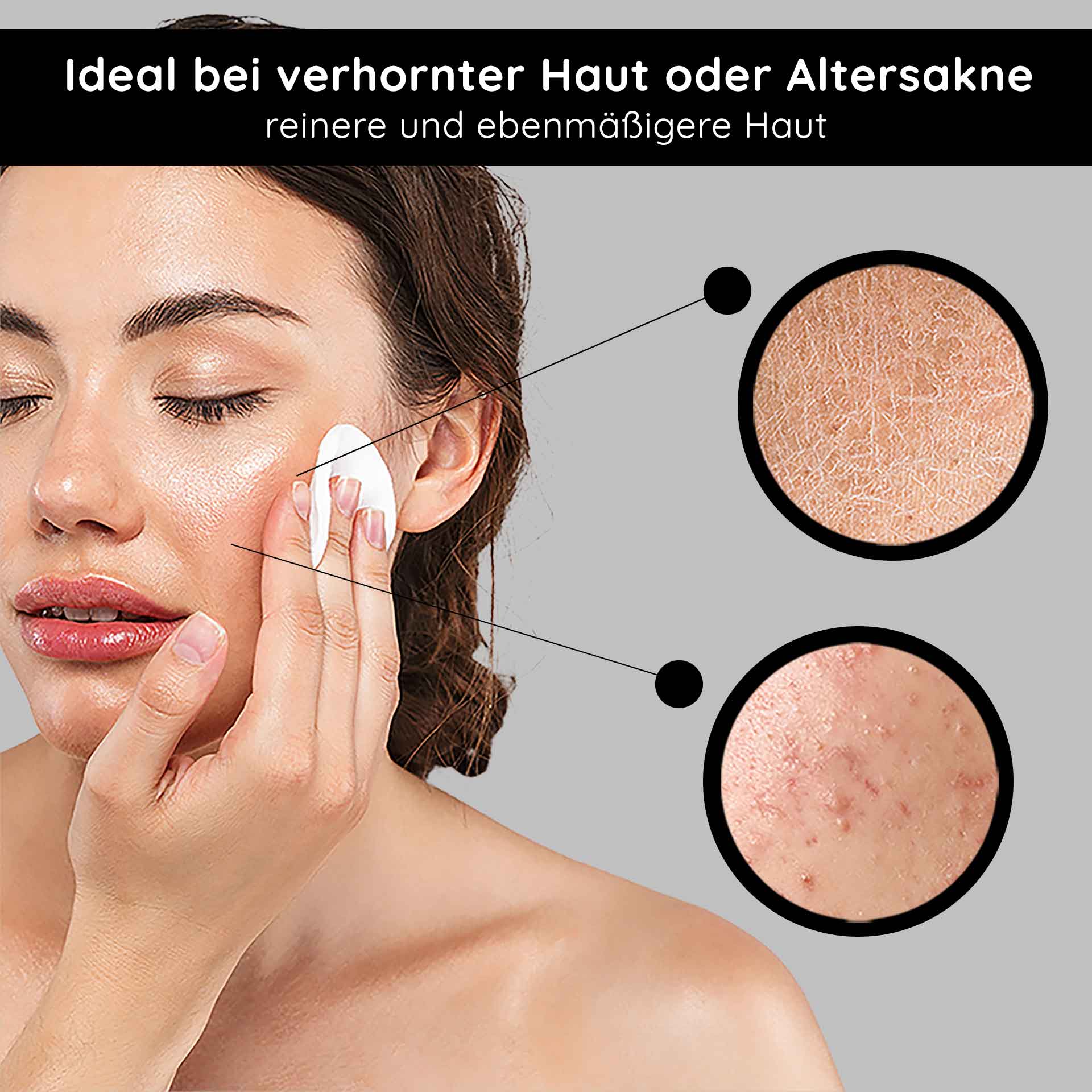 AHA Tonic 1000 ml Tonique doux aux acides de fruits Frau mit Wattepad, das AHA Tonic auf Gesicht aufträgt, ideal bei verhornter Haut oder Altersakne, zeigt Hautunreinheiten und Texturverbesserung.